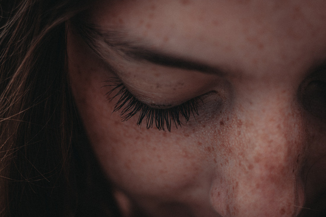 WHAT TRIGGERS HYPERPIGMENTATION AND WHAT KIND OF TYPES ARE THERE?